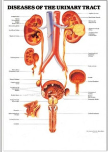 3D해부도(벽걸이)/ 9797/배뇨기의 질병( DISEASES OF THE URINARY TRACT )/ 54cm ⅹ 74cm