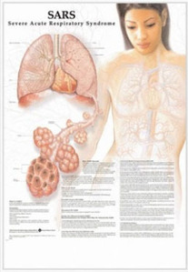 3D해부도(벽걸이)/ 9784/중증급성호흡기증후군 SARS / 54cm ⅹ 74cm