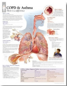 평면해부도 (벽걸이) /1355 /만성폐쇄성 폐질환 COPD &amp; Asthma