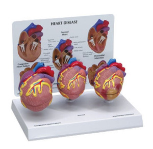 G255 심장질환3가지모형 /3-pc Mini Heart Set Models 255