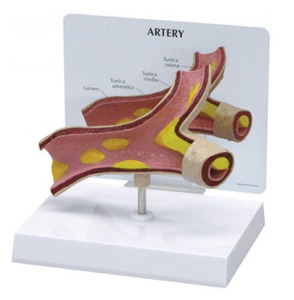(미국GPI)동맥경화모형(G260) / Artery 260  순환계모형