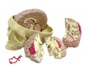 [미국GPI] 뇌모형(G290) / Brain and Partial Skull 290**