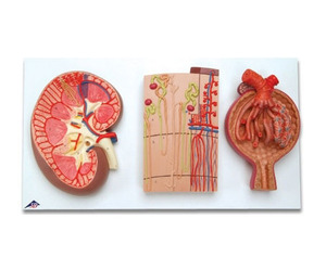 [3B] 신사단면모형 K11(29x52x9cm/2.55kg) ▶Kidney Section, Nephrons, Blood Vessels and Renal Corpuscle