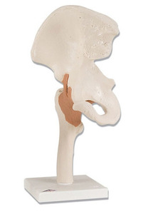 [3B]고관절모형(A81)/ functional hip joint