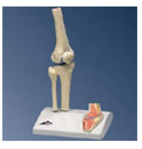 [3B] 미니무릎(A85/1)/ mini knee joint with cross section