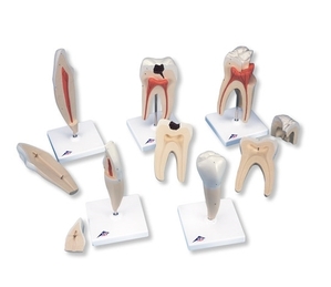 [3B] D10 치아시리즈 / Classic Tooth Model Series, 5 models